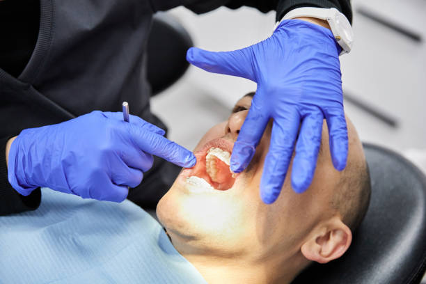 Best Emergency Treatment for Dental Infections or Abscesses in Colfax, IA