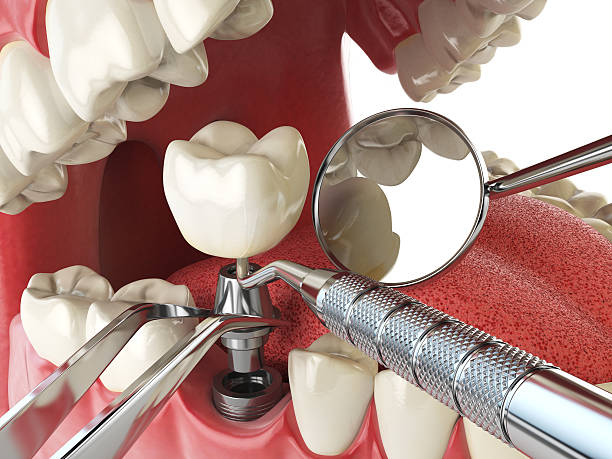 Best Same-Day Emergency Dental Services in Colfax, IA